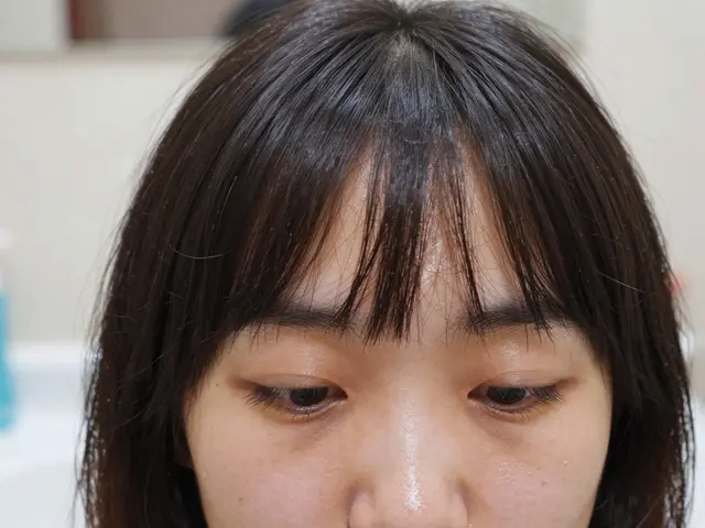 Can Having Bangs Worsen Acne? Here's What Actually Happens