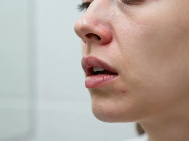 How to Get Rid of a Skin Burn After Waxing Your Upper Lip: A Complete Guide