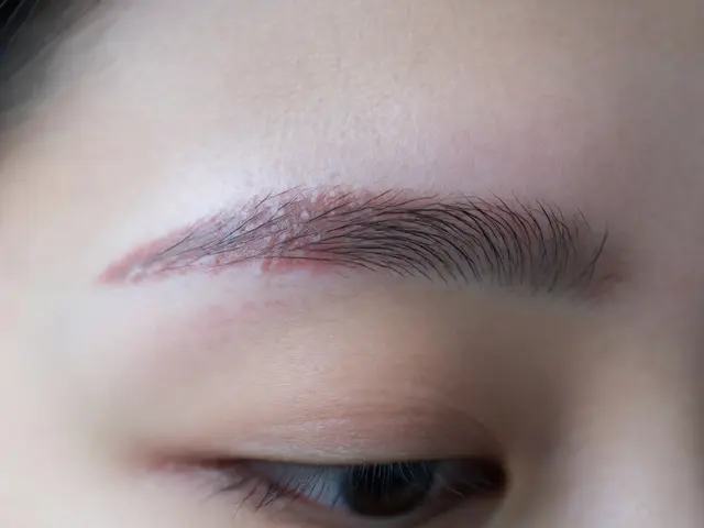 Fixing Post-Wax Bumps and Eyebrow Wax Burns: A Practical Guide